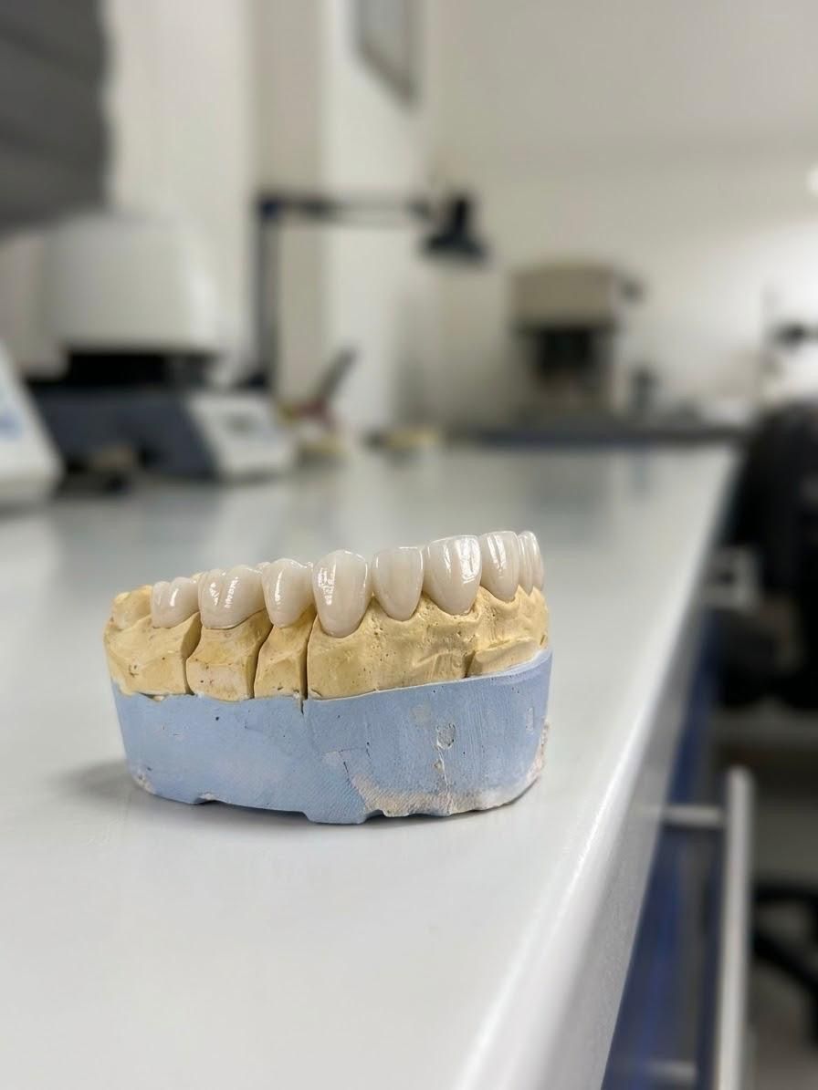 Dental laboratory models and crowns